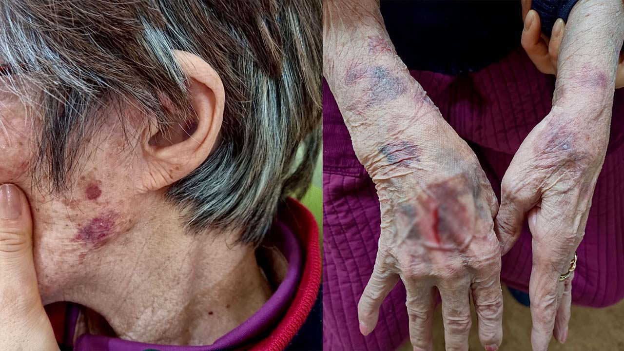 온라인커뮤니티 - 네이트판